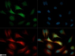 GPIHBP1 Antibody, Novus Biologicals 0.1mL; Unlabeled:Antibodies, Polyclonal
