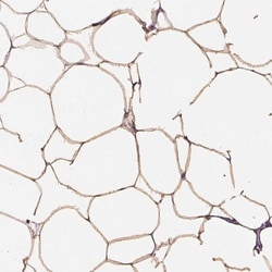 GPIHBP1 Antibody, Novus Biologicals 0.1mL; Unlabeled:Antibodies, Polyclonal