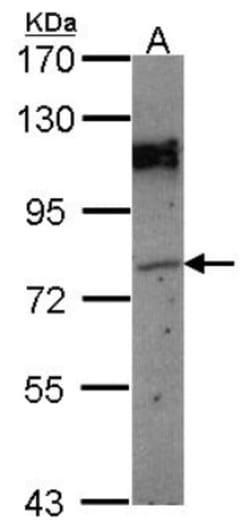 GPIP137 Antibody, Novus Biologicals 0.1mL; Unlabeled:Antibodies, Polyclonal