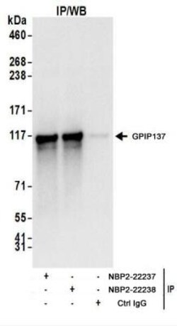 GPIP137 Antibody, Novus Biologicals 0.1mg; Unlabeled:Antibodies, Polyclonal