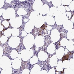 GP-IX Antibody, Novus Biologicals:Antibodies:Primary Antibodies