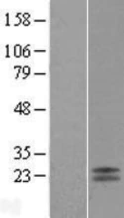 Novus Biologicals&trade;&nbsp;GP-IX Overexpression Lysate