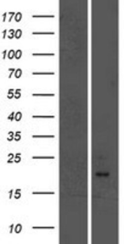 Novus Biologicals&trade;&nbsp;GPI-PLD/GPLD1 Overexpression Lysate