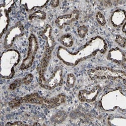 GPI-PLD/GPLD1 Antibody, Novus Biologicals:Antibodies:Primary Antibodies