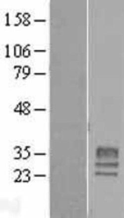 Novus Biologicals&trade;&nbsp;GPM6A Overexpression Lysate