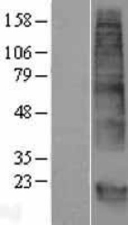 Novus Biologicals&trade;&nbsp;GPM6B Overexpression Lysate