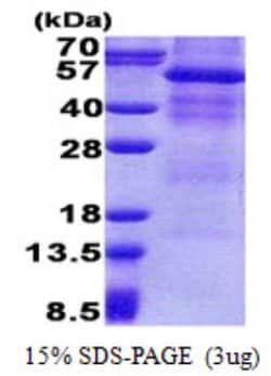 Novus Biologicals&trade;&nbsp;Recombinant Human Osteoactivin/GPNMB His Protein