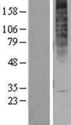 Novus Biologicals&trade;&nbsp;GPR1 Overexpression Lysate