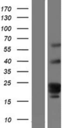 Novus Biologicals&trade;&nbsp;GPR107 Overexpression Lysate
