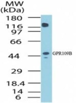 GPR109B/HM74 Antibody, Novus Biologicals:Antibodies:Primary Antibodies