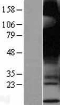 Novus Biologicals&trade;&nbsp;GPR12 Overexpression Lysate