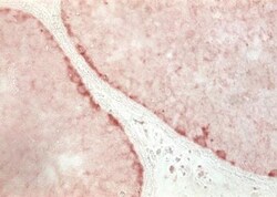 GPR125 Antibody, Novus Biologicals 0.1mg; Unlabeled:Antibodies, Polyclonal