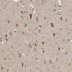 PON3 Antibody, Novus Biologicals:Antibodies:Primary Antibodies