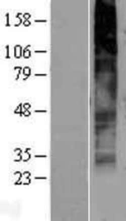 Novus Biologicals&trade;&nbsp;GPR141 Overexpression Lysate