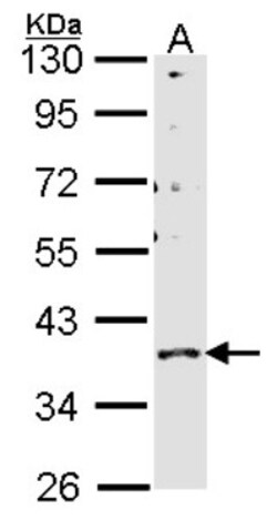GPR146 Antibody, Novus Biologicals 0.1mL; Unlabeled:Antibodies, Polyclonal