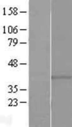 Novus Biologicals&trade;&nbsp;GPR146 Overexpression Lysate
