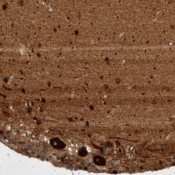 GPR150 Antibody, Novus Biologicals 25 &mu;L; Unlabeled:Antibodies, Polyclonal