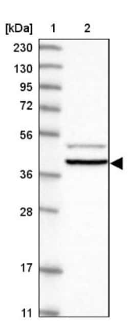 GPR152 Antibody, Novus Biologicals 25 &mu;L | Buy Online | Novus Biologicals | Fisher Scientific