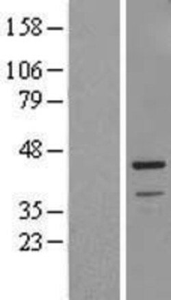 Novus Biologicals&trade;&nbsp;GPR154 Overexpression Lysate