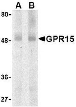 GPR15 Antibody - BSA Free, Novus Biologicals 0.025 mg | Buy Online | Novus Biologicals | Fisher Scientific