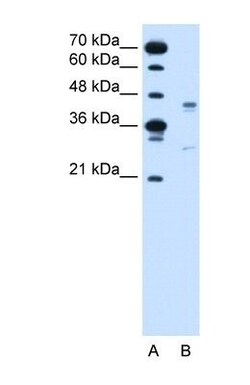 GPR161 Antibody, Novus Biologicals 100&mu;L; Unlabeled:Antibodies, Polyclonal