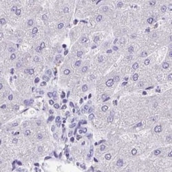 GPR162 Antibody, Novus Biologicals 0.1mL; Unlabeled:Antibodies, Polyclonal