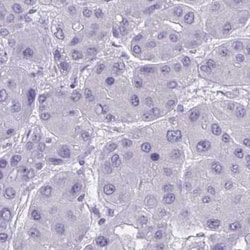 GPR162 Antibody, Novus Biologicals 0.1mL; Unlabeled:Antibodies, Polyclonal