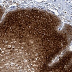 GPR164 Antibody, Novus Biologicals 0.1mL; Unlabeled:Antibodies, Polyclonal