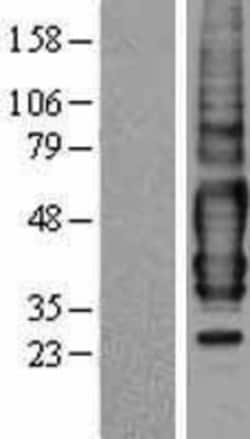 Novus Biologicals&trade;&nbsp;GPR175 Overexpression Lysate