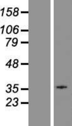 Novus Biologicals&trade;&nbsp;GPR18 Overexpression Lysate