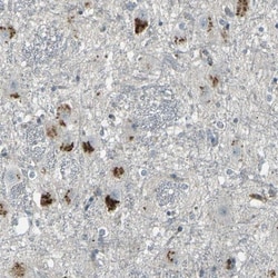 GPR19 Antibody, Novus Biologicals 25 &mu;L; Unlabeled:Antibodies, Polyclonal