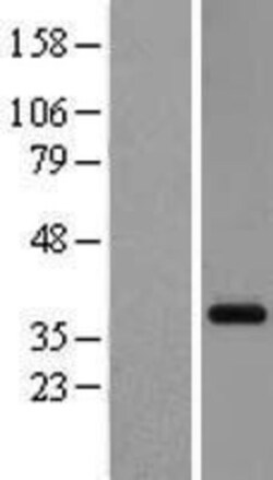 Novus Biologicals&trade;&nbsp;GPR26 Overexpression Lysate