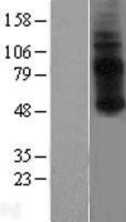 Novus Biologicals&trade;&nbsp;GPR3 Overexpression Lysate
