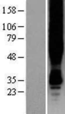 Novus Biologicals&trade;&nbsp;GPER/GPR30 Overexpression Lysate