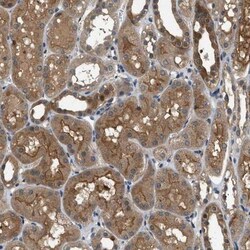 GPR31 Antibody, Novus Biologicals 0.1mL; Unlabeled:Antibodies, Polyclonal