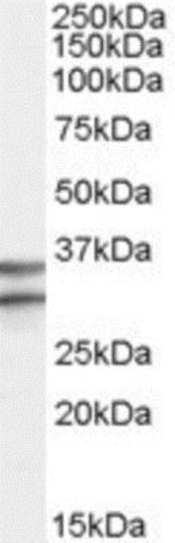 GPR3 Antibody, Novus Biologicals 0.1mg; Unlabeled:Antibodies, Polyclonal