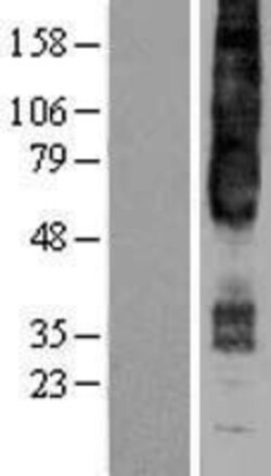 Novus Biologicals&trade;&nbsp;GPR4 Overexpression Lysate