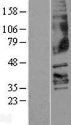 Novus Biologicals&trade;&nbsp;FFAR3/GPR41 Overexpression Lysate