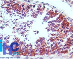 CRTH-2/GPR44 Antibody (54N3F8) - BSA Free, Novus Biologicals 0.025mg; Unlabeled:Antibodies,