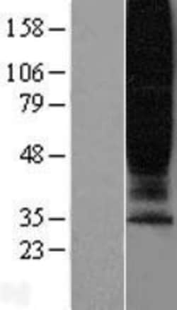 Novus Biologicals&trade;&nbsp;GPR45 Overexpression Lysate