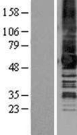 Novus Biologicals&trade;&nbsp;GPR50 Overexpression Lysate