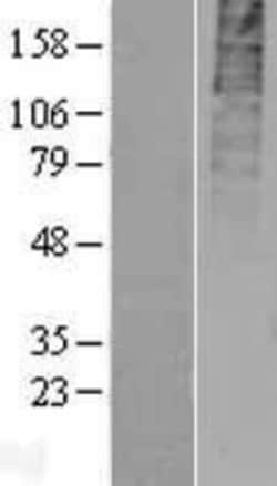 Novus Biologicals&trade;&nbsp;GPR55 Overexpression Lysate