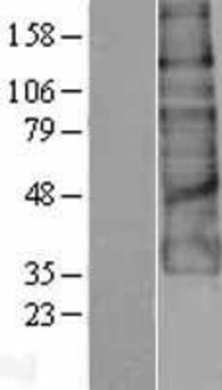 Novus Biologicals&trade;&nbsp;GPR56 Overexpression Lysate