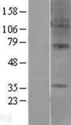 Novus Biologicals&trade;&nbsp;GPR6 Overexpression Lysate