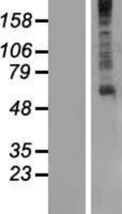 Novus Biologicals&trade;&nbsp;GPR61 Overexpression Lysate