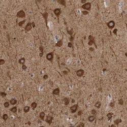 GPR61 Antibody, Novus Biologicals:Antibodies:Primary Antibodies