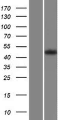 Novus Biologicals™ GPR63 Overexpression Lysate
