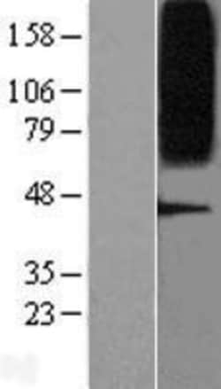 Novus Biologicals&trade;&nbsp;GPR75 Overexpression Lysate
