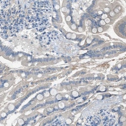 CDS1 Antibody, Novus Biologicals:Antibodies:Primary Antibodies