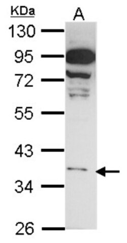 GPR81 Antibody, Novus Biologicals 0.1mg; Unlabeled:Antibodies, Polyclonal